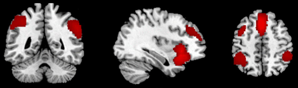 The Neuroscience of Deception